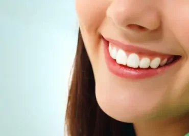 Need That Smile? Try TruSmile’s Snap-On Dental Veneers